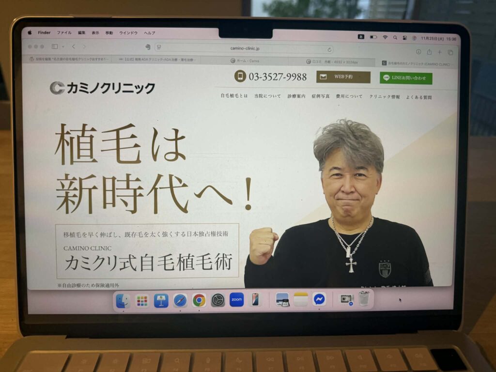 カミノクリニック　おすすめ　比較