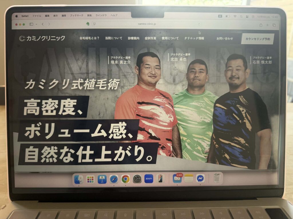 カミノクリニック おすすめ 比較