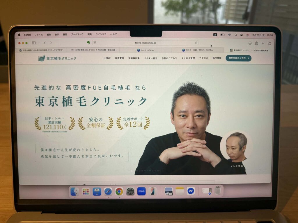 東京植毛クリニック　おすすめ　比較