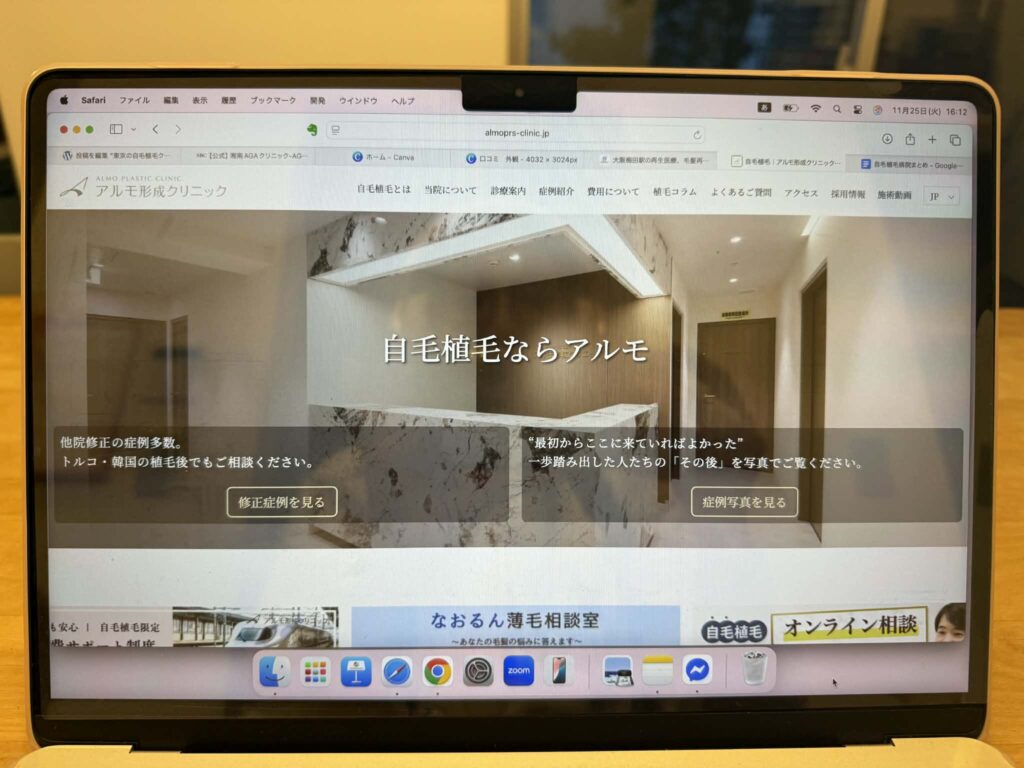 アルモ形成クリニック　おすすめ　比較