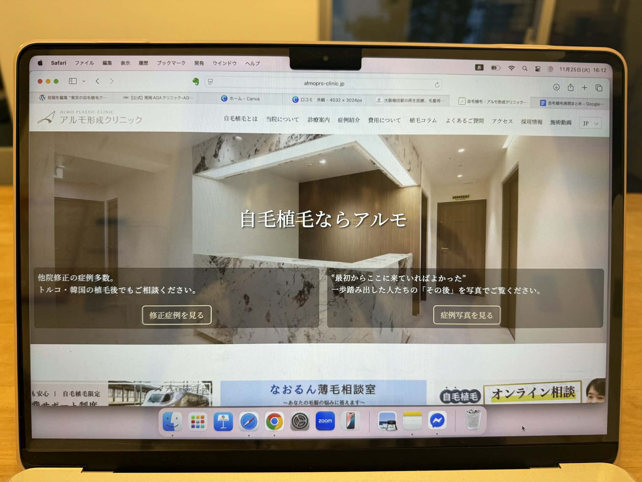 アルモ形成クリニック　おすすめ　比較
