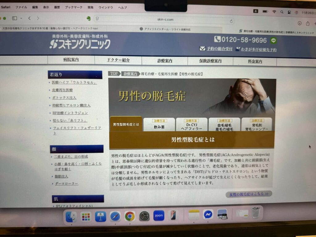 大宮スキンクリニック　おすすめ　比較