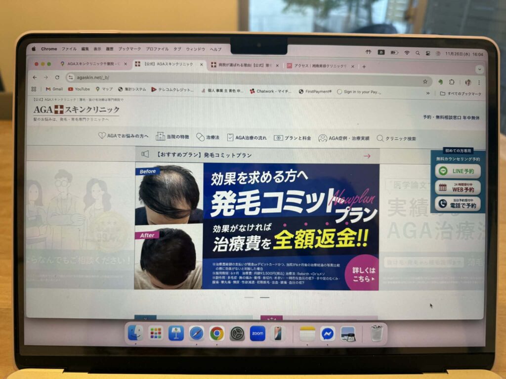 AGAスキンクリニック千葉院　比較