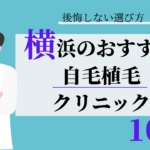 横浜　自毛植毛　比較