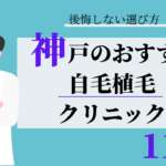 神戸　自毛植毛　おすすめ　比較