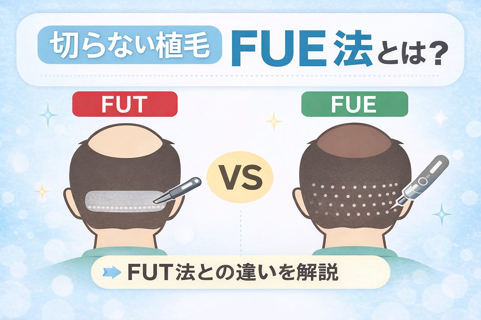 植毛ってどうやる?切らないFUE法を解説