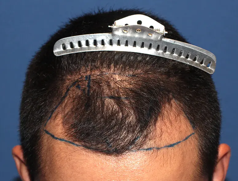 親和クリニック 症例case62