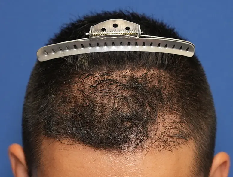 親和クリニック 症例case62