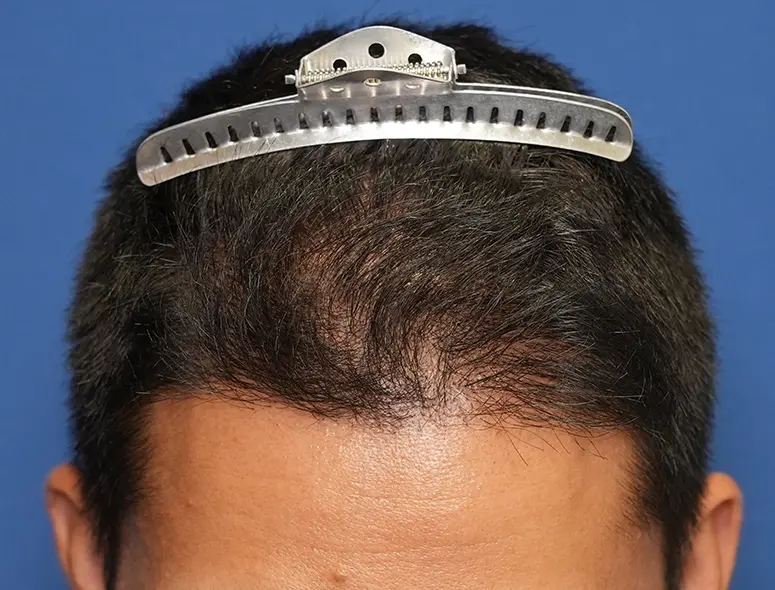 親和クリニック 症例case62