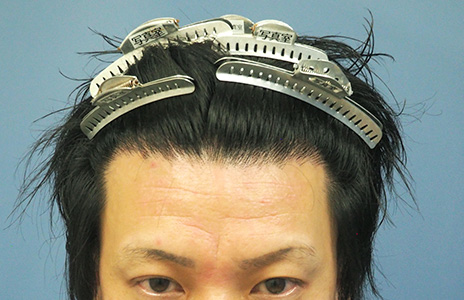 アイランドタワー　症例