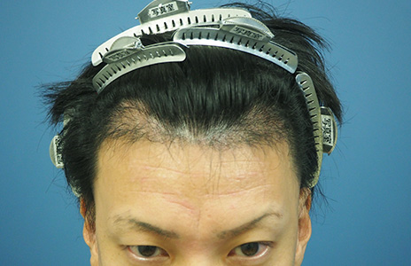 アイランドタワー　症例