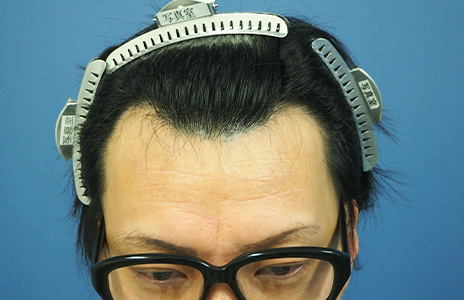 アイランドタワー　症例