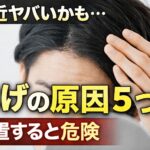 はげ　原因　男性