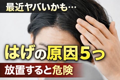 はげ　原因　男性
