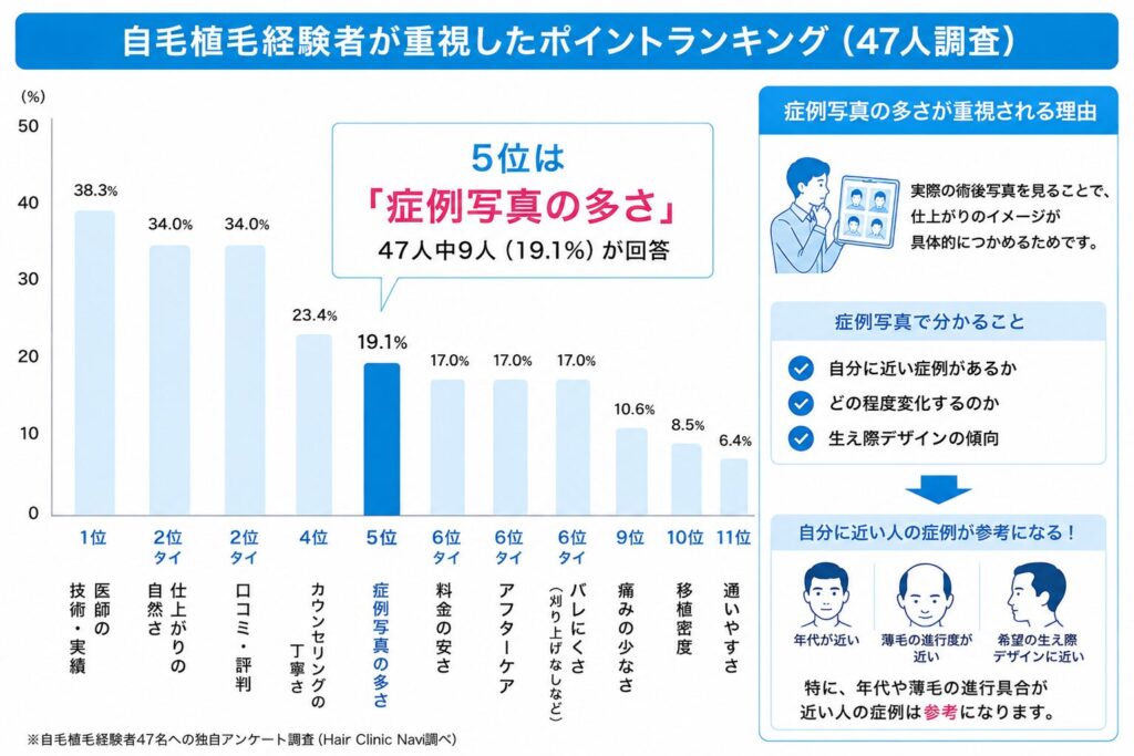自毛植毛アンケート5位 症例写真の多さ
